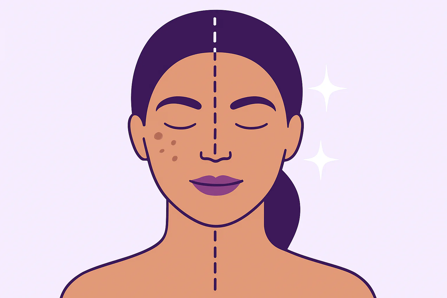 Acné: Más Allá de un Grano